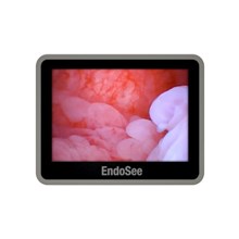 Endosee-Handheld-Hysteroscope_Screen-View.jpg