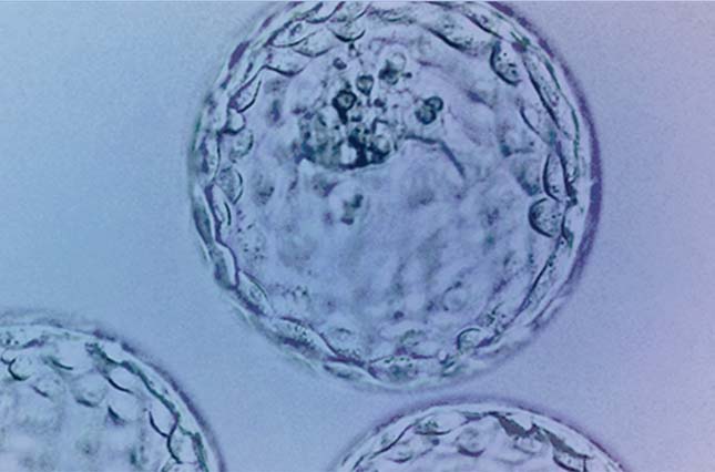 Procedure-embryoTransfer-FI