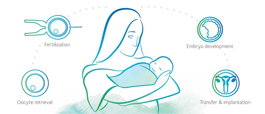 IVF 101