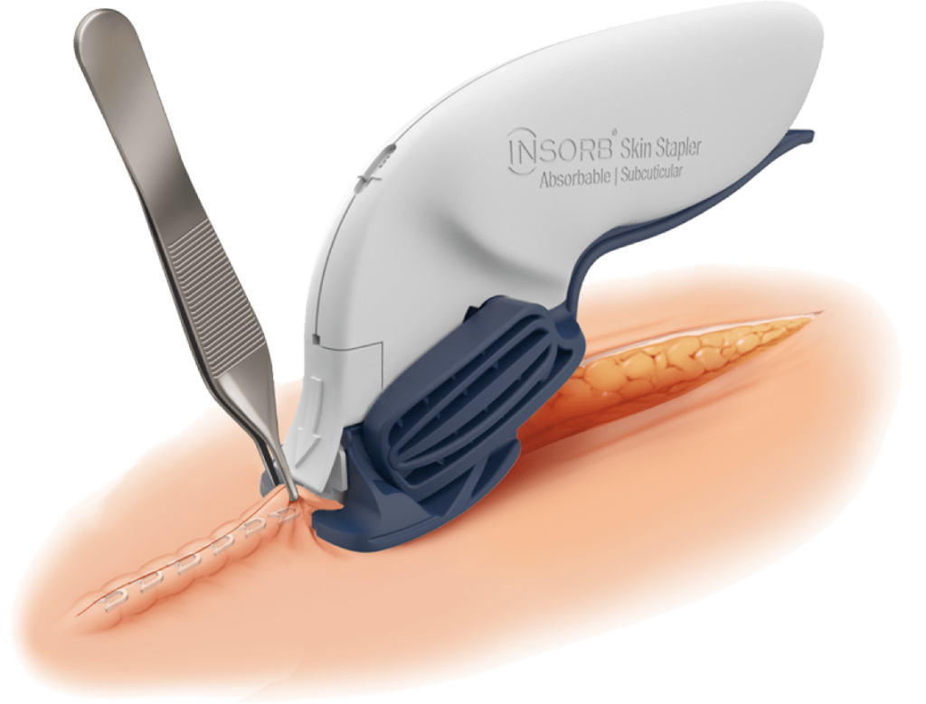 hero-insorb@2x-1024x779