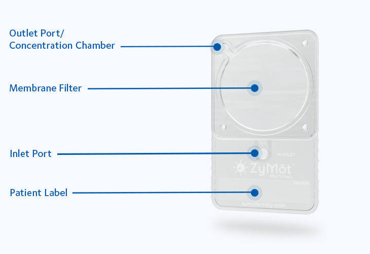 Zymot-point-diagram
