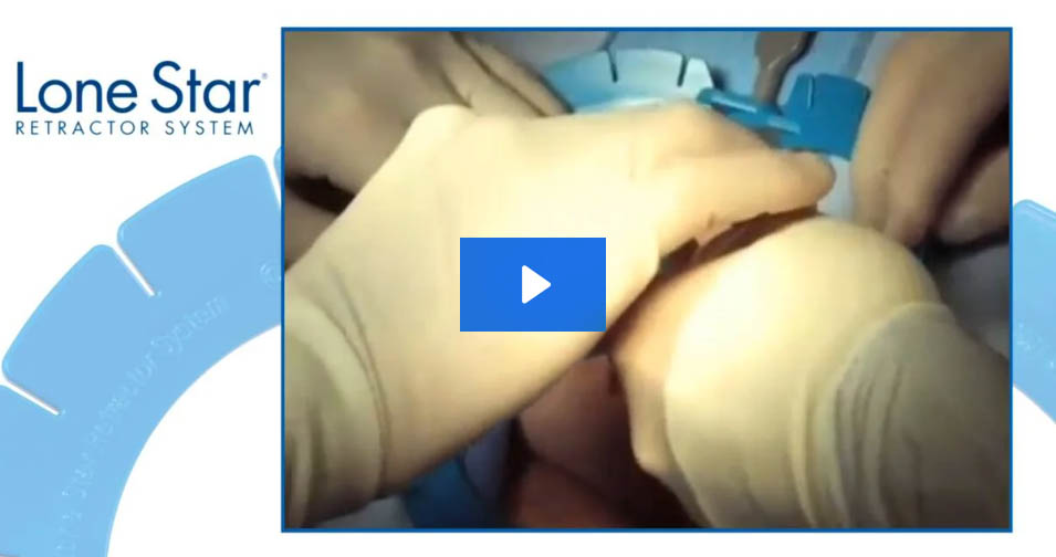 lone-star-colorectal