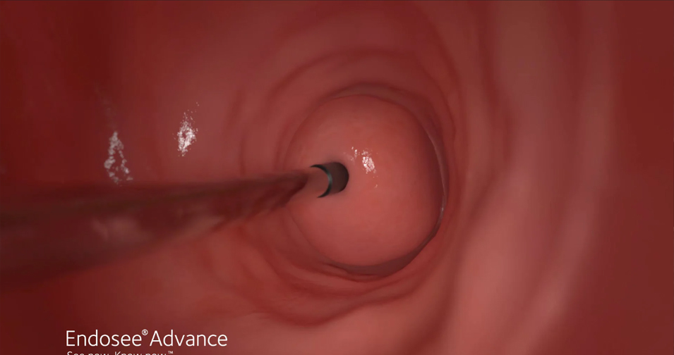 endosee-see-now-thumbnail