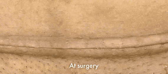 1-img-a-surgery-at-surgery