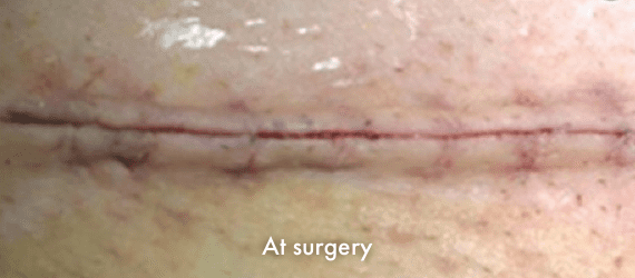 3-img-b-surgery-1