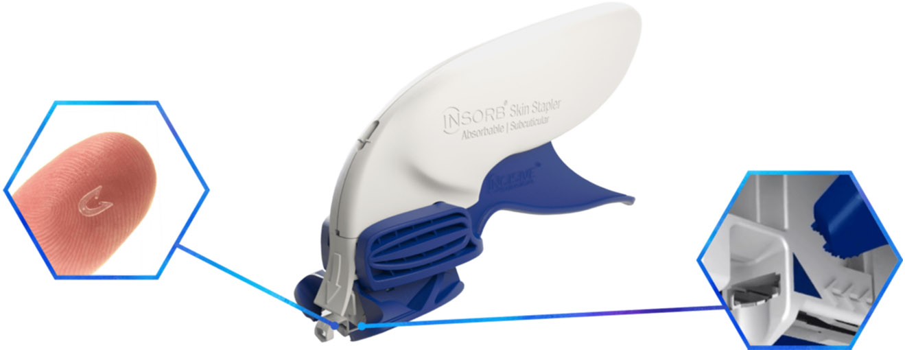 Insorb-hexagon-diagram-1320