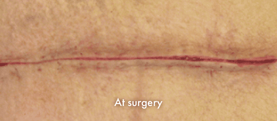 img-a-surgery-2