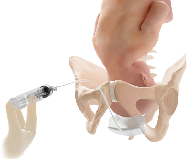 Baby-fetal-billow-closeup-long