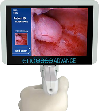 Endosee-handheld-version2
