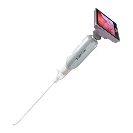 Full, side-view of Endosee Handheld Hysteroscopy System, with diagnostic image on screen