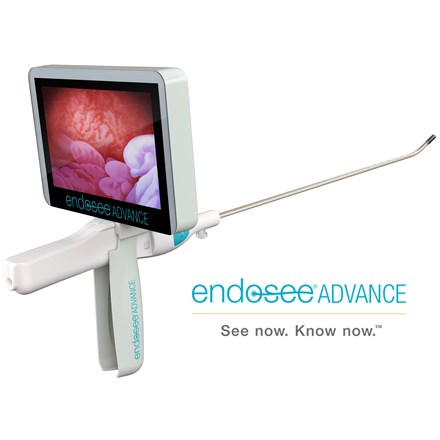Advertisement for Endosee Advance System with diagnostic image on screen
