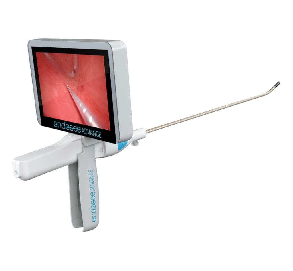 Endosee handheld, portable, cordless hysteroscopy